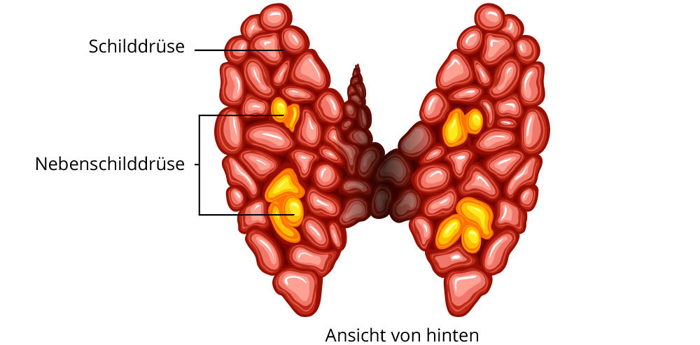 Nebenschilddrüse Überfunktion