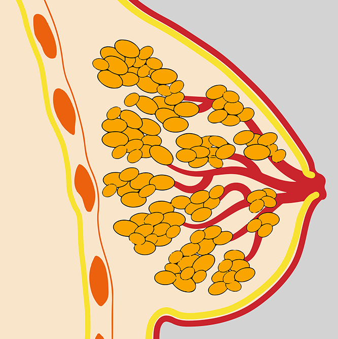 Brustkrebs Diagnose